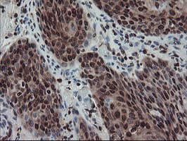 FMR1 / FMRP Antibody (aa36-279, clone OTI5B9)