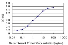 IHC-plus™ Monoclonal Mouse anti-Human TXN / Thioredoxin / TRX Antibody (clone 2A7, IHC, IF, WB)