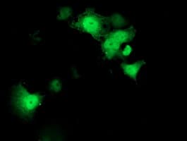 Monoclonal Mouse anti-Human STAT4 Antibody (clone OTI2F3, IHC, IF, WB)