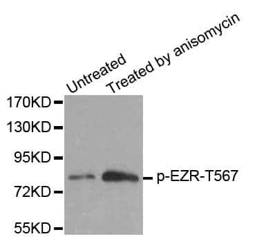 EZR / Ezrin Antibody (phospho-Thr567)