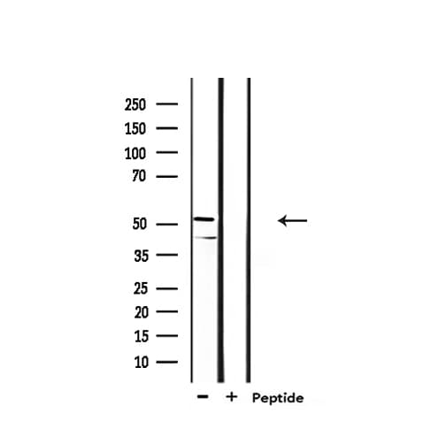 Polyclonal Rabbit anti-Human GSK3A / GSK3 Alpha Antibody (IHC, WB)