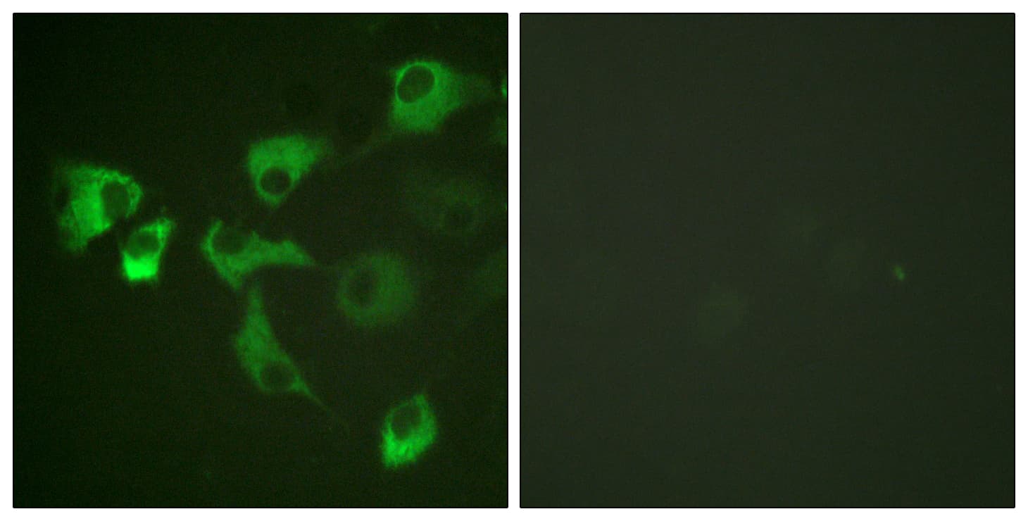 Polyclonal Rabbit anti-Human EEF2 / Elongation Factor 2 Antibody (phospho-Thr56, IHC, IF, WB)