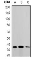 MTX1 / Metaxin 1 Antibody