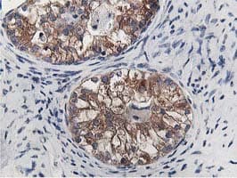 OSBP Antibody (clone OTI1F2)
