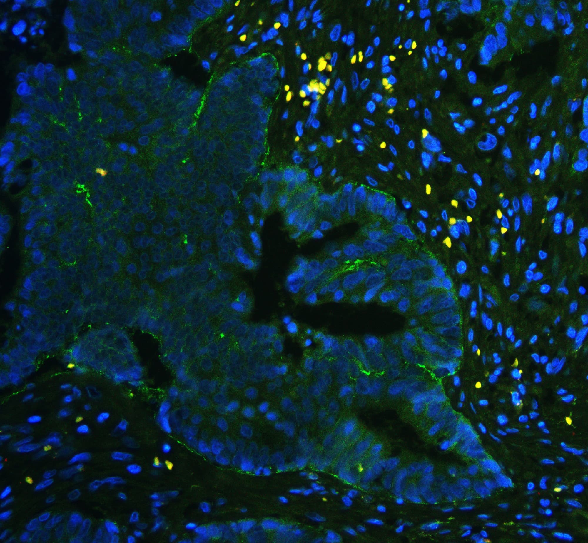 Polyclonal Rabbit anti-Human ITGA5/Integrin Alpha 5/CD49e Antibody (IHC, WB)