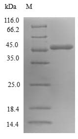 Human SAR1A / SAR1 Protein (Recombinant GST, N-terminus)
