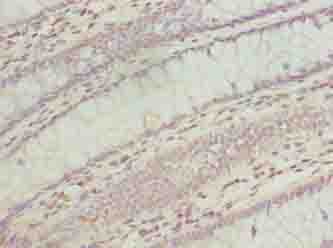Polyclonal Rabbit anti-Human TMEM243 Antibody (IHC)
