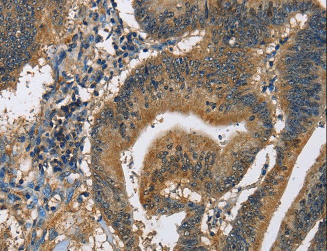 Polyclonal Rabbit anti-Human CAST / Calpastatin Antibody (IHC, WB)