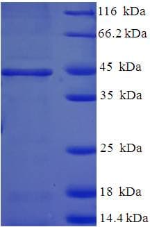 Human HSD17B14 Protein (Recombinant His-SUMO)