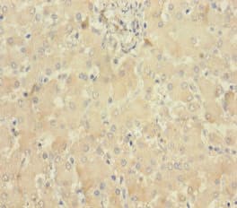 MLKL Antibody (aa1-471)