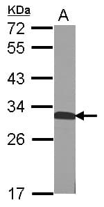 QDPR / DHPR Antibody