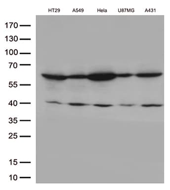 Monoclonal Mouse anti-Human KLF5 / BTEB2 Antibody (clone OTI6D2, aa1, IHC, WB)