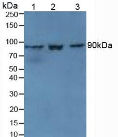 TGM1 / Transglutaminase Antibody (aa337-607)