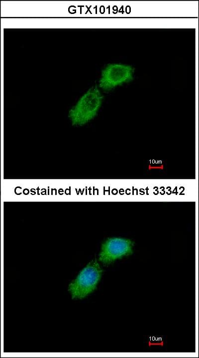 Polyclonal Rabbit anti-Human TBCB / CKAP1 Antibody (aa1-243, IHC, WB)