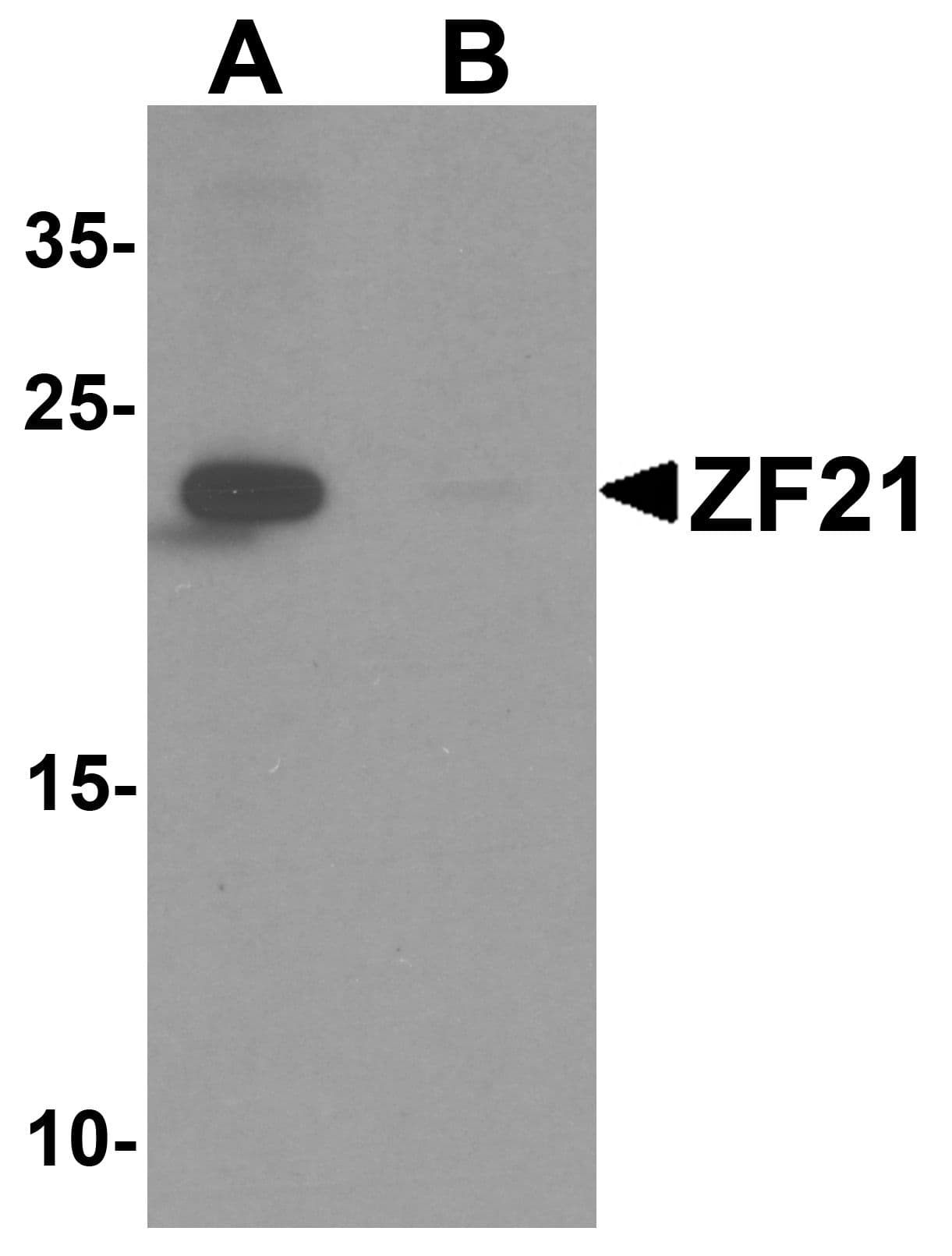 IHC-plus™ ZFYVE21 Antibody