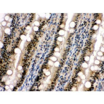 Polyclonal Rabbit anti-Human MAPK13 / p38delta Antibody (aa332-365, IHC, WB)