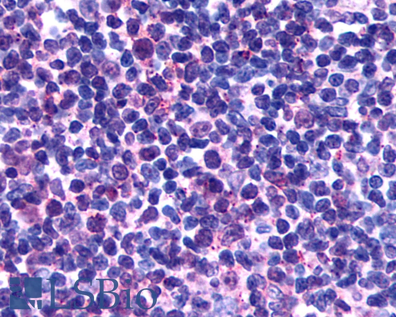 PathPlus™ Polyclonal Rabbit anti-Human GPR146 Antibody (Cytoplasmic Domain, IHC)