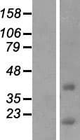 CCDC153 Protein (Over-Expression Lysate Myc-DDK (Flag))