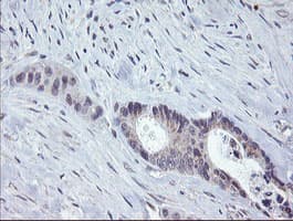 CHN1 Antibody (clone OTI2D10, Carrier-free)