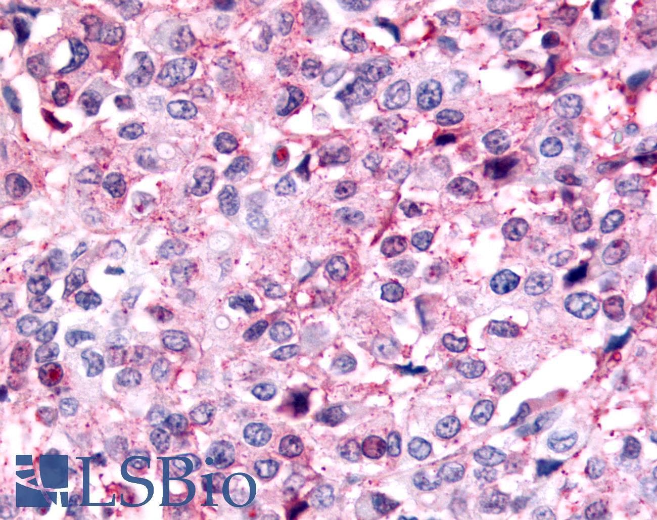 PathPlus™ PAK6 Antibody (Linker Domain)