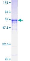 Human RPA2 / RFA2 / RPA34 Protein (Recombinant GST)