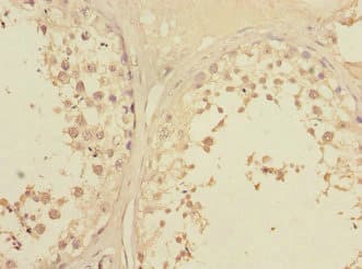 LFNG / Lunatic Fringe Antibody