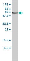 Monoclonal Mouse anti-Human ORC2L / ORC2 Antibody (clone 3E11-1G5, WB)