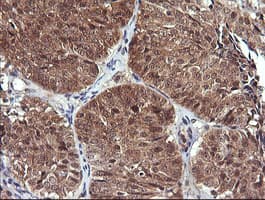 Monoclonal Mouse anti-Human DDT / Dopamine Tautomerase Antibody (clone OTI1A1, IHC, WB)
