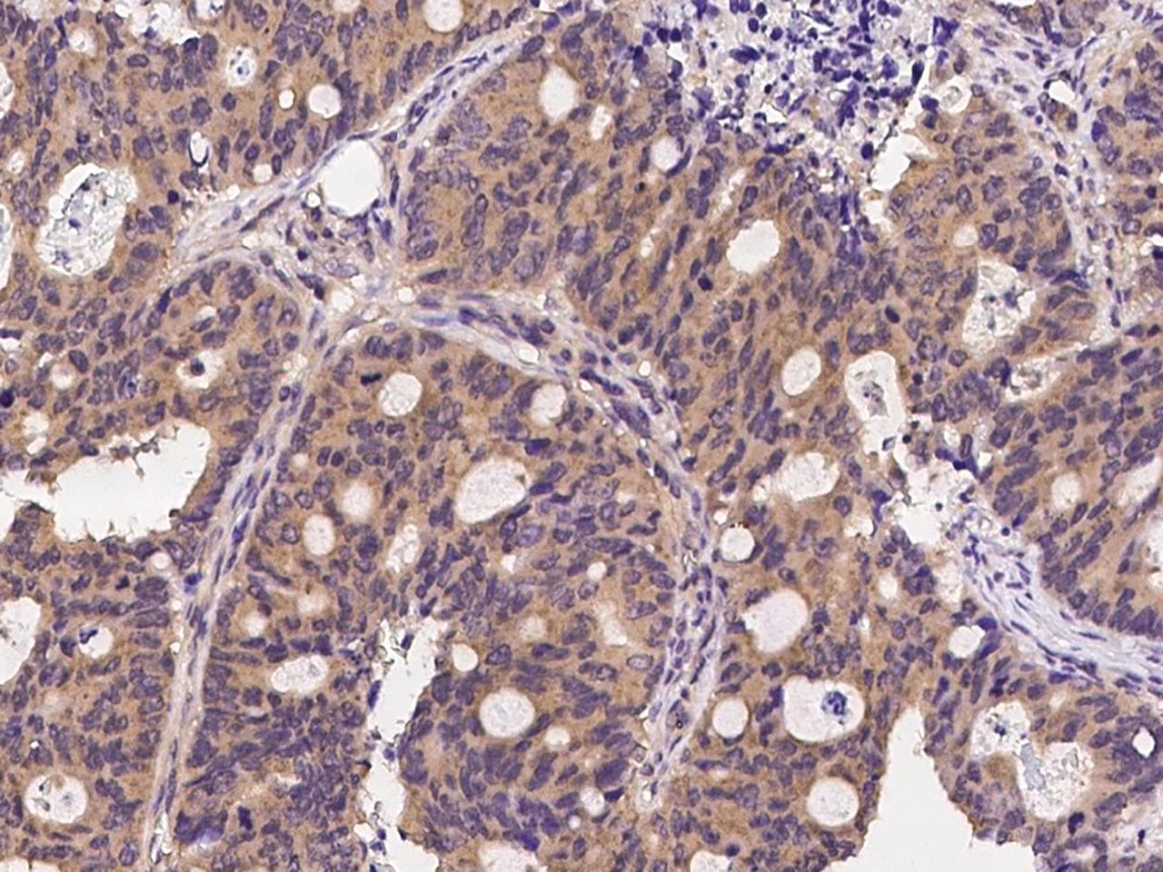 Polyclonal Rabbit anti-Human CLTC / Clathrin Heavy Chain Antibody (IHC, WB)