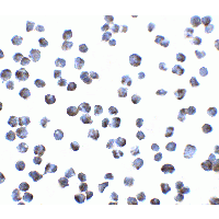 BOB / GPR15 Antibody
