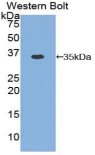 CCND1 / Cyclin D1 Antibody (aa1-292)
