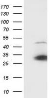 SSX1 Antibody (clone OTI2G5)