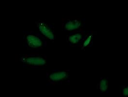 AP50 / AP2M1 Antibody (aa97-383, clone OTI1B11)