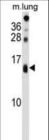 DEXI Antibody (aa56-82)