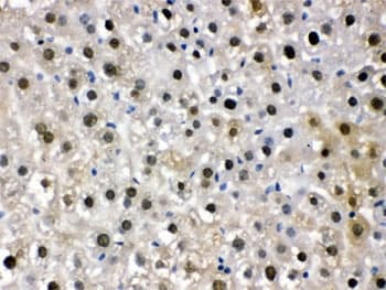 Polyclonal Rabbit anti-Human DDB1 Antibody (IHC, WB)