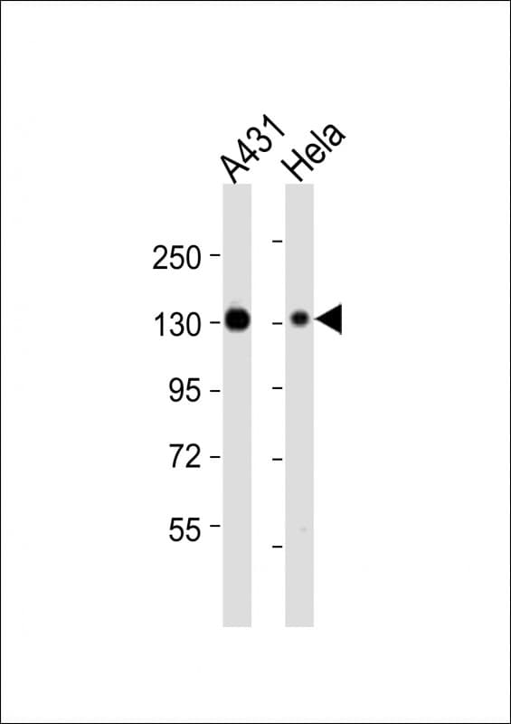 ITGA3 / CD49c Antibody (aa165-199)