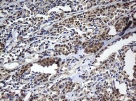CBX8 Antibody (aa1-260, clone OTI2B2, Carrier-free)