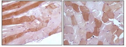 Monoclonal Mouse anti-Human MB / Myoglobin Antibody (clone 6H8B5, 5A2G8, 4D7H3, 3H6A7, IHC, WB)