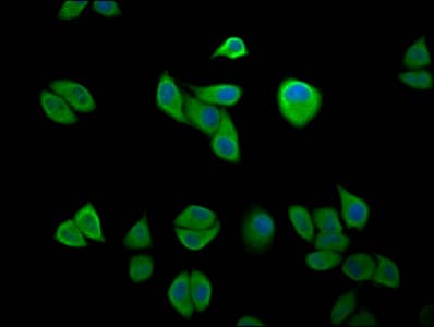 IKBKAP / IKAP Antibody