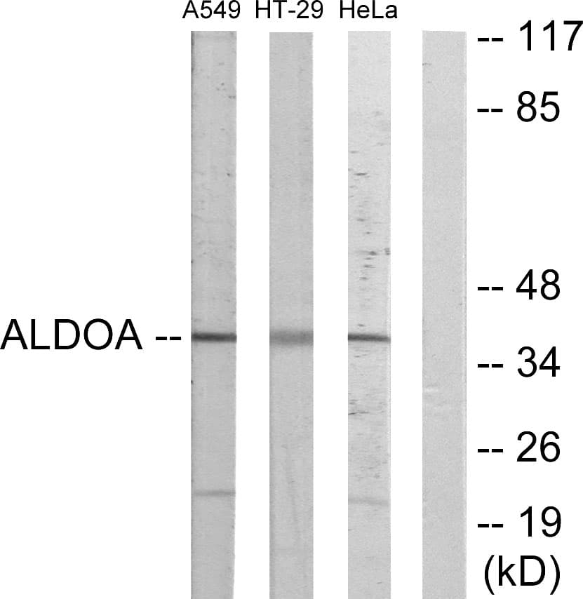 ALDOA / Aldolase A Antibody (aa1-50)
