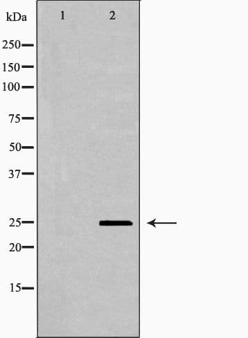 PRDX6 / Peroxiredoxin 6 Antibody