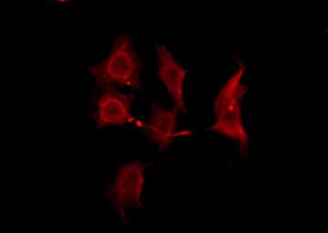 OR2B8P Antibody