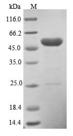 Human PHLDA1 Protein (Recombinant 6His, N-terminus)