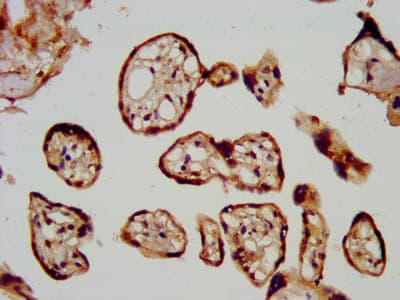 LGMN / Legumain Antibody