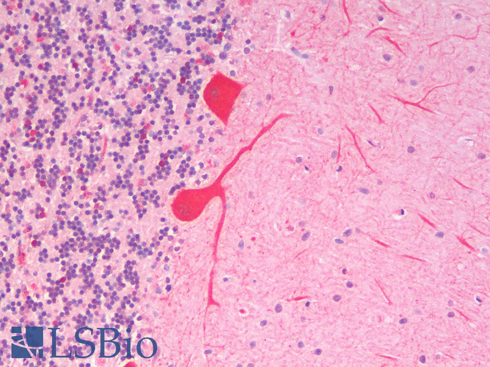 IHC-plus™ SLC7A6 Antibody (N Terminus)