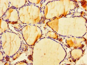Polyclonal Rabbit anti-Human CIART / C1orf51 Antibody