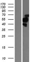 TBRG1 Protein (Over-Expression Lysate Myc-DDK (Flag))