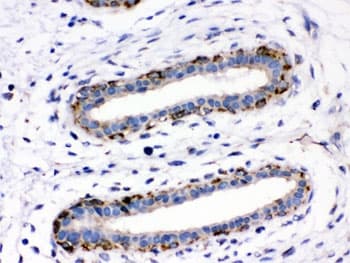 Polyclonal Rabbit anti-Human Junctin / ASPH Antibody (IHC, WB)