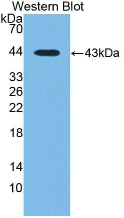 CTBS / CTB Antibody (aa47-385, PE)