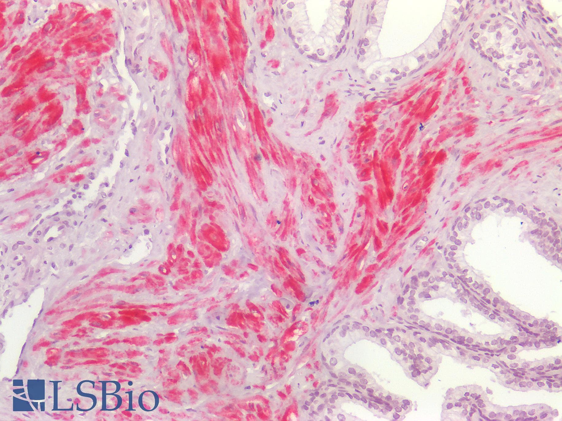 PathPlus™ Smoothelin Antibody (clone R4A)